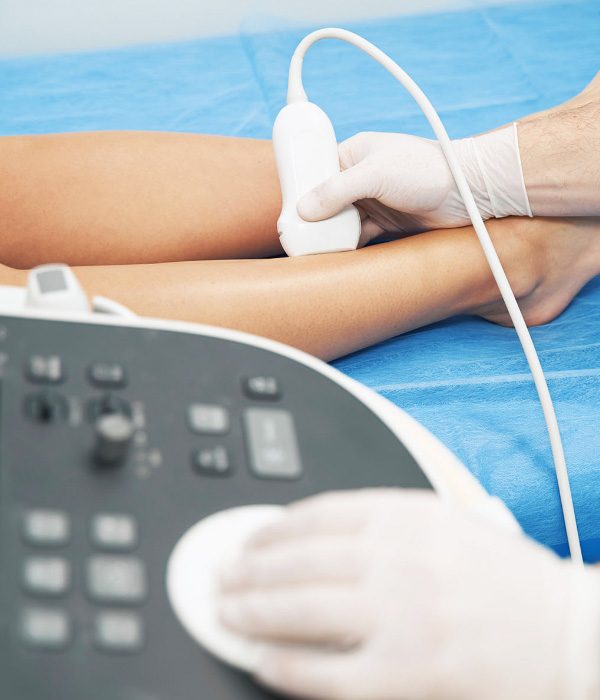 Ecografie Doppler arterială, membre inferioare sau superioare