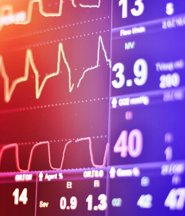 Electrocardiograma (EKG)